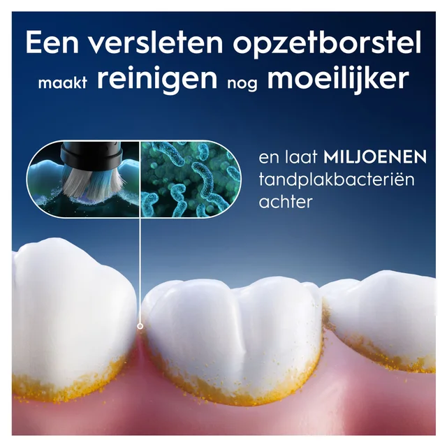 Oral-B iO Interdental Clean Opzetborstels Voor Beugels Wit, 2 Stuks