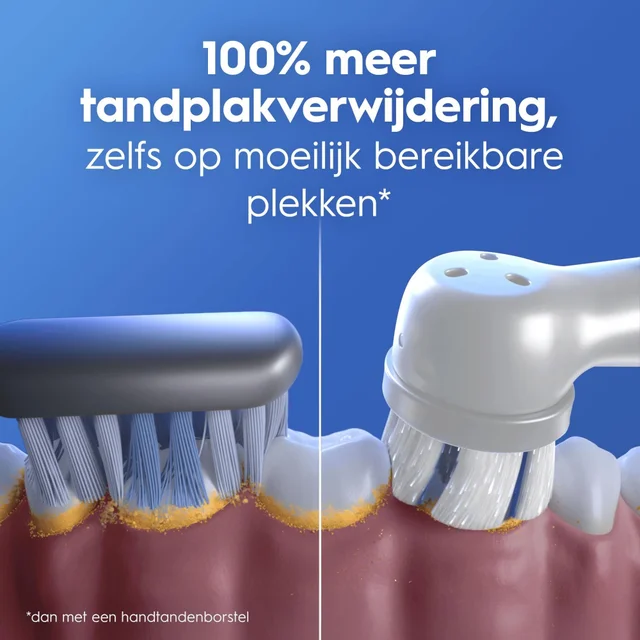 Oral-B iO 2 Elektrische Tandenborstel Roze